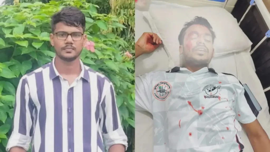 কুবিতে লোহার শিকল দিয়ে সহপাঠীকে পিটিয়ে রক্তাক্ত করলো শিক্ষার্থী শাহপরান