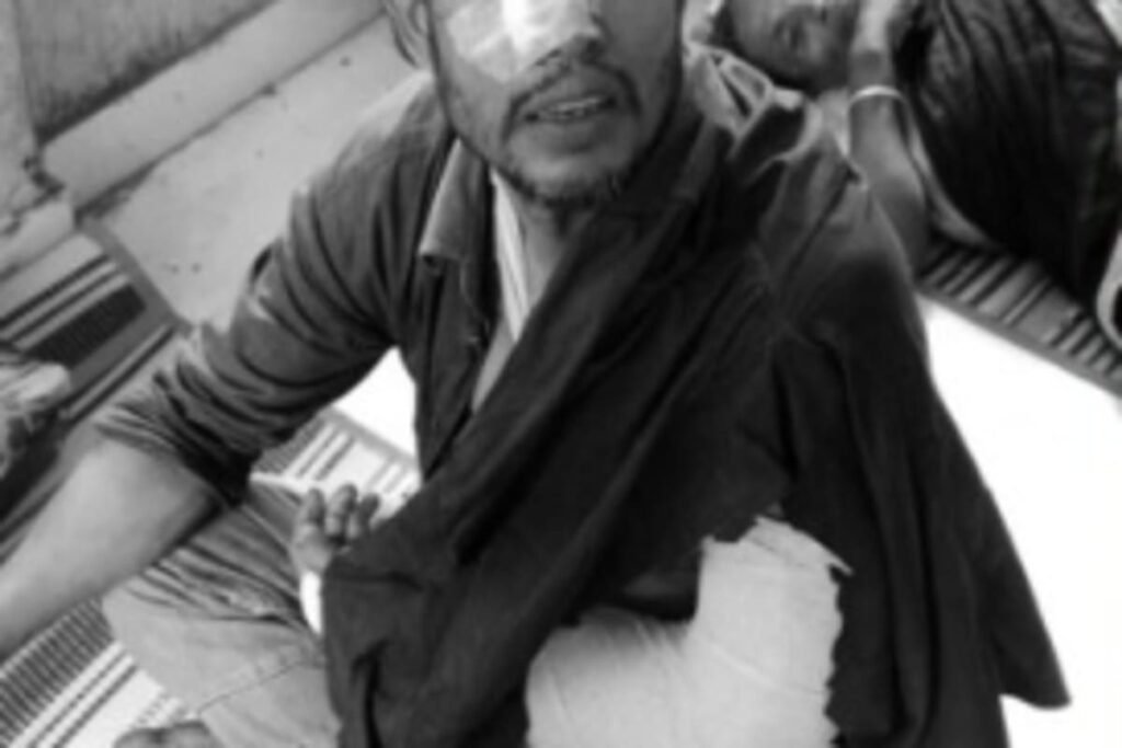 যশোরে পারিবারিক কলহের জেরে আপন ভাইকে রামদা দিয়ে কুপিয়ে জখম